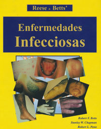 traducción médica de enfermedades infecciosas