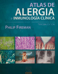 Traducción médica del Atlas de Alergia e Inmunología Clínica