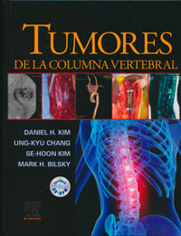 traducción médica de tumores en la columna vertebral