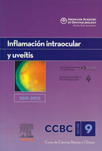 traducción médica de la inflamación intraocular y uveítis